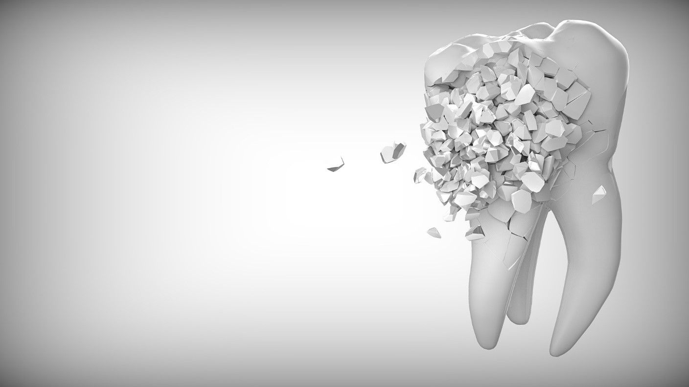 6 svarīgi iemesli, kāpēc jāaizstāj zaudētie zobi
