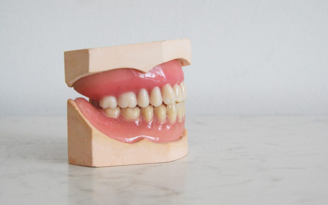 dzelteni zobi
